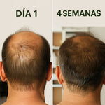 Aceite de Batana®:Da brillo, hidrata y fortalece | Envío Gratis 🎁