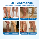 Adiós al dolor de várices con Varicose Veins ®️